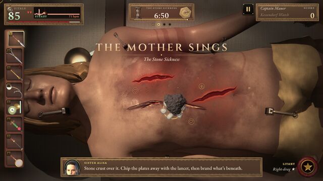 The Mother Sings, The Stone Sickness: a crust of stone plates over a patient's cuts (full size, 1920 × 1080)